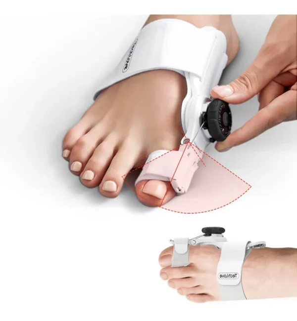 Corrector De Juanetes Graduable