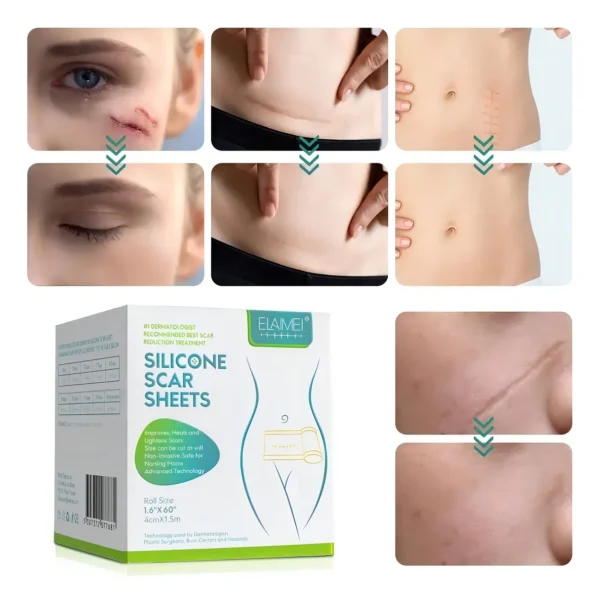 Cinta de Silicona para Eliminar Cicatrices - Imagen 5