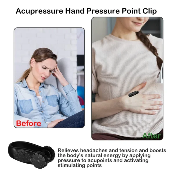 Clips De Acupresión Para Migraña - Imagen 3