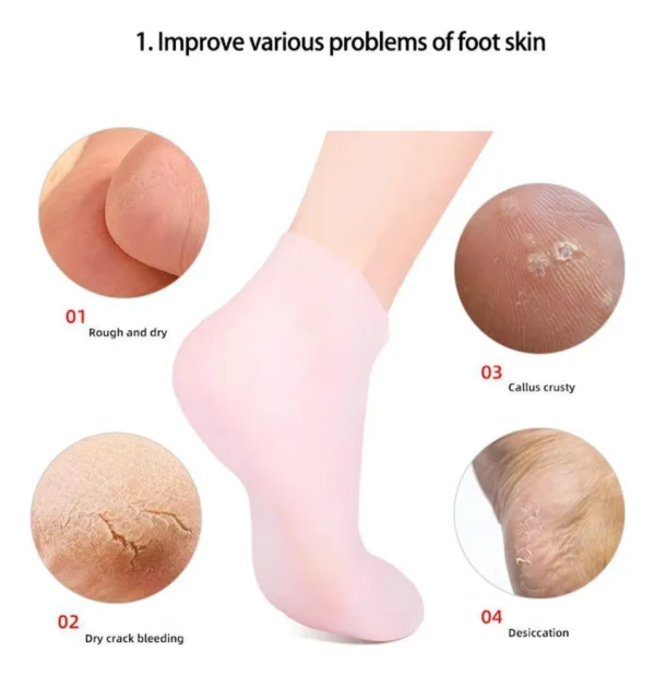 Medias de Silicona para Cuidado de Pies - Imagen 6