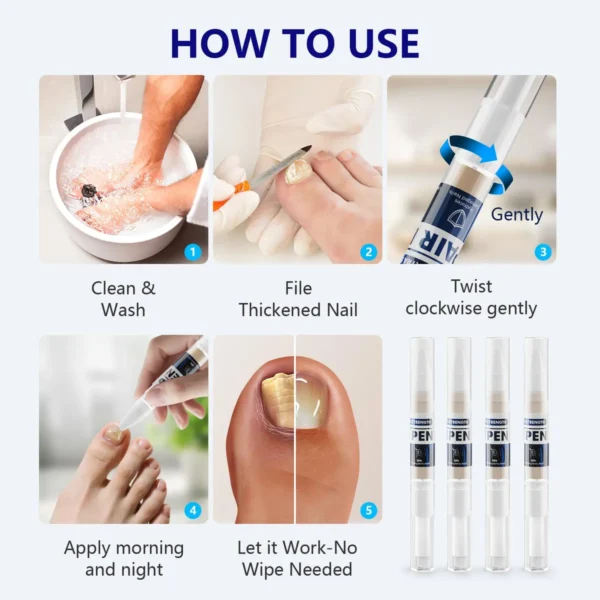 Bolígrafo De Tratamiento De Hongos 3ml - Imagen 3
