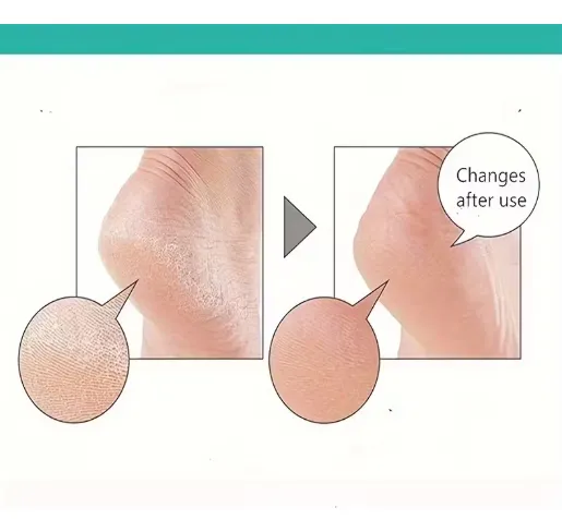 Protector Para Talones De Silicona - Imagen 7