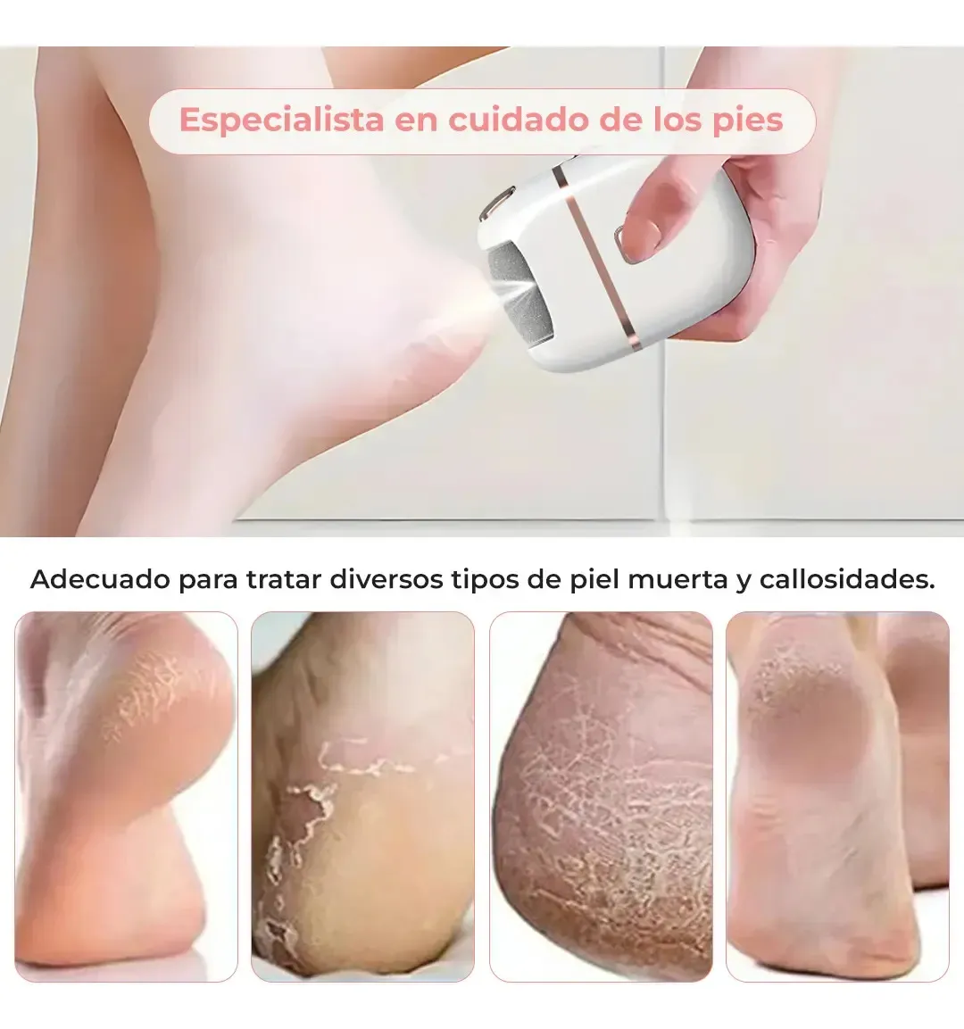 Eliminador Eléctrico Recargable de Callos - Imagen 2