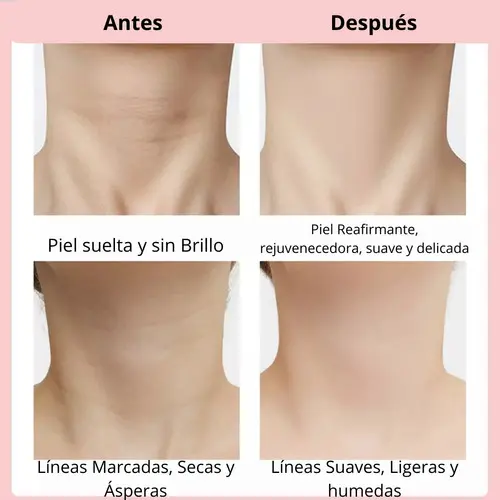 Mascarilla de Hidrogel para Cuello - Imagen 5